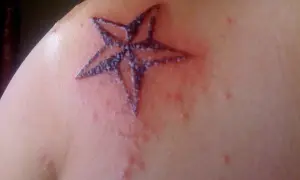 Un tatuaje de estrella en el hombro, con piel enrojecida y con pequeños bultos alrededor. Es normal que pique un tatuaje después de meses.