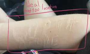 Brazo con cicatrices, rodeado por un marco rosa. El texto escrito en rosa dice "Ideal tattoo location".