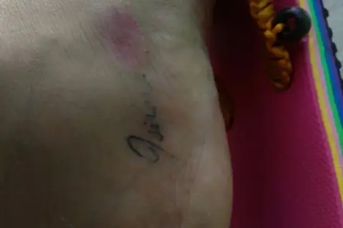 Mi tatuaje se pela y pierde color, mostrando la piel debajo. Se ve un brazalete con cuentas.