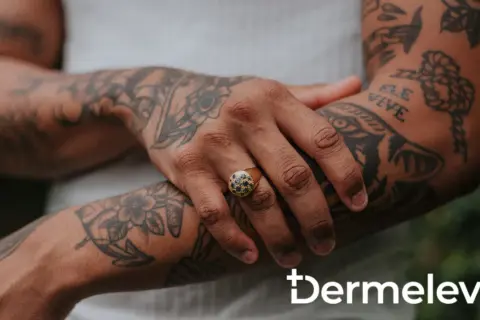 Brazo con tatuajes y un anillo con piedras oscuras. La piel luce sana, sin rastro de costra de tatuaje.