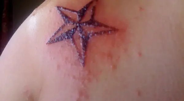 Un tatuaje de estrella en el hombro, con piel enrojecida y con pequeños bultos alrededor. Es normal que pique un tatuaje después de meses.