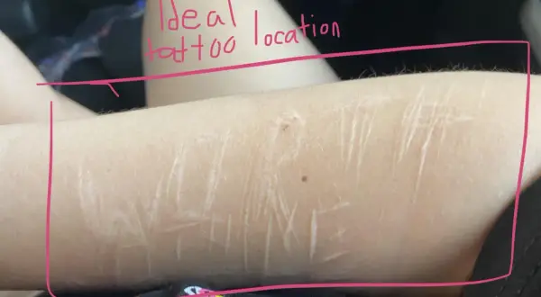 Brazo con cicatrices, rodeado por un marco rosa. El texto escrito en rosa dice "Ideal tattoo location".