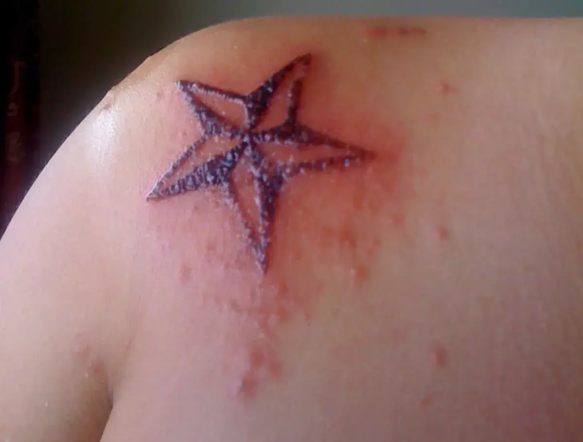 Un tatuaje de estrella en el hombro, con piel enrojecida y con pequeños bultos alrededor. Es normal que pique un tatuaje después de meses.