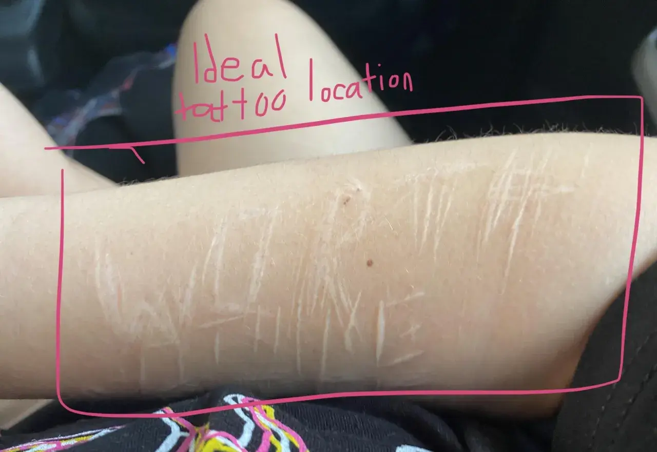 Brazo con cicatrices, rodeado por un marco rosa. El texto escrito en rosa dice "Ideal tattoo location".