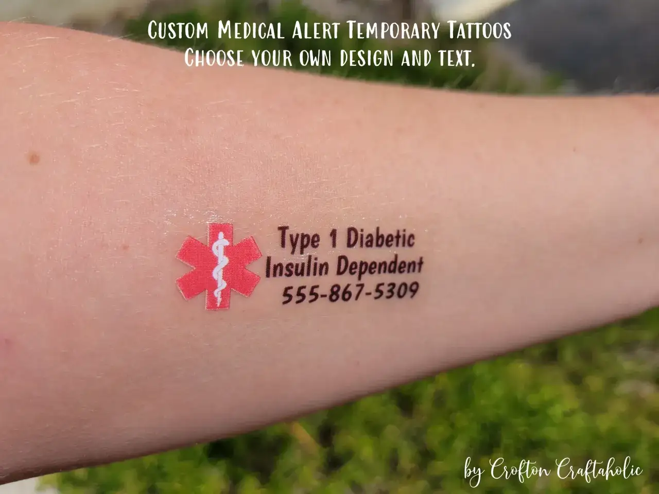Tatuajes médicos temporales en un brazo: